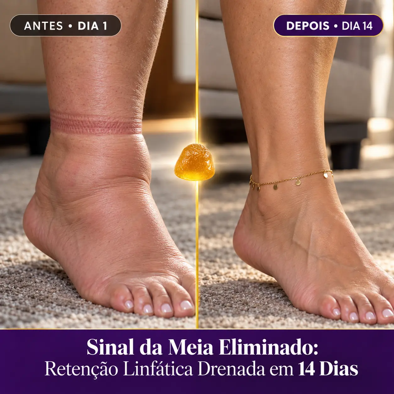 Antes e depois: Sinal da Meia